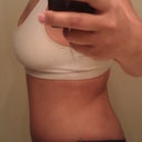 13 days post side view