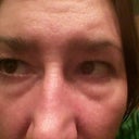 35 weeks