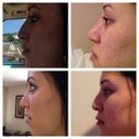 some before and after shots, 3rd week in.