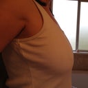 Side view pre op. you can see the sag
