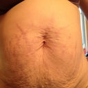 The Belly! Just enough skin to hold the stretch marks together!