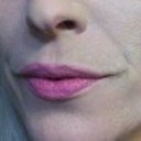 2 weeks before Sculptra