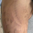 4 weeks after 15th session.