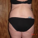 and the back side
