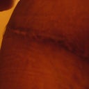 right side above hip scar line looking great!