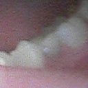 the tooth in the middle is the implant