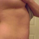 the moles on my right side so that I can compare their placements before & afterwards