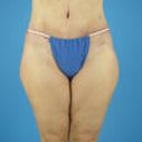 Front 6 wks