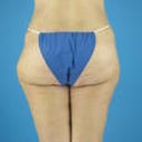 Rear at 6 wks