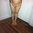 0NE WEEK BEFORE SURGERY