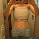 Day after surgery 2-2-12