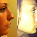 side view as of today 3/16/12