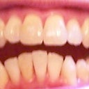 6-6-2012 Tray 7/24