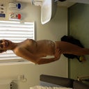 Other side view .... My surgeon is magic !