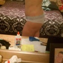 The rt side. Before the touch up lipo.