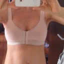 3 days post op .
