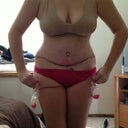 Post op Day 3