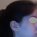 before, left side