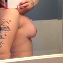 Post op week 9/ left side