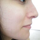 Before Profile