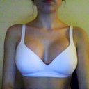 Post op day 19. In the same bra as before, they are definetly settling down, In my opinion they dont look as high and "fake-looking" as they did on day 9.
