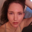 Approximately 60 hours after surgery. Bruising on neck and sides of face will become more visible in the days following, as expected.