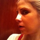 tip swelled up!! but cuute!! even though i have monster jowls, cheek swelling is the worst!!