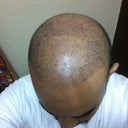 9 days after