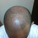 9 days after