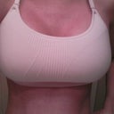 2nd week Post Op