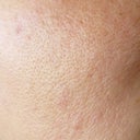 Bumps, lines, slits, lines of pores, marks, stains, rough texture.