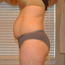 Before - side