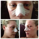 Day 4 sorry no makeup or pretty hair. We are getting there!