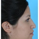 Original profile
