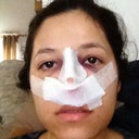 Day of surgery