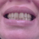 Tray 21 without aligners