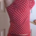 3 weeks post op