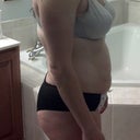 Side before pic