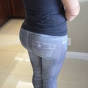 2 week post-op