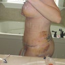 SOOO swollen