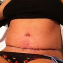day 1 ...swollen not very impressive