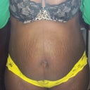 Front view ** All out ***