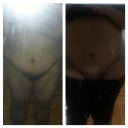 left 33 days post op, right almost 14 weeks post op(today)