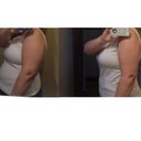 A side by side compare of my arms