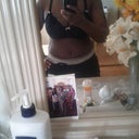 5 weeks post opt and very swollen.