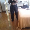 5 weeks post opt very happy minus the swelling