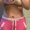 6 weeks PO revision