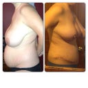 Before/after 
Somewhere between 4-5 weeks