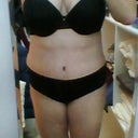 Day 12, 2 pounds less than presurgery weight!  Still very swollen.