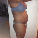 before side view...